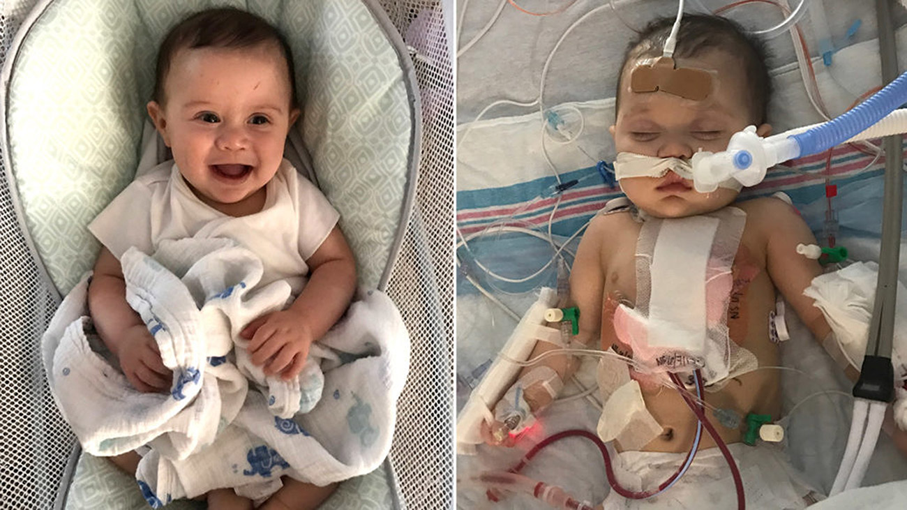 Jeremiah Powers had open-heart surgery at Cleveland Clinic Children’s to repair a hole in the lower chambers of the heart.
