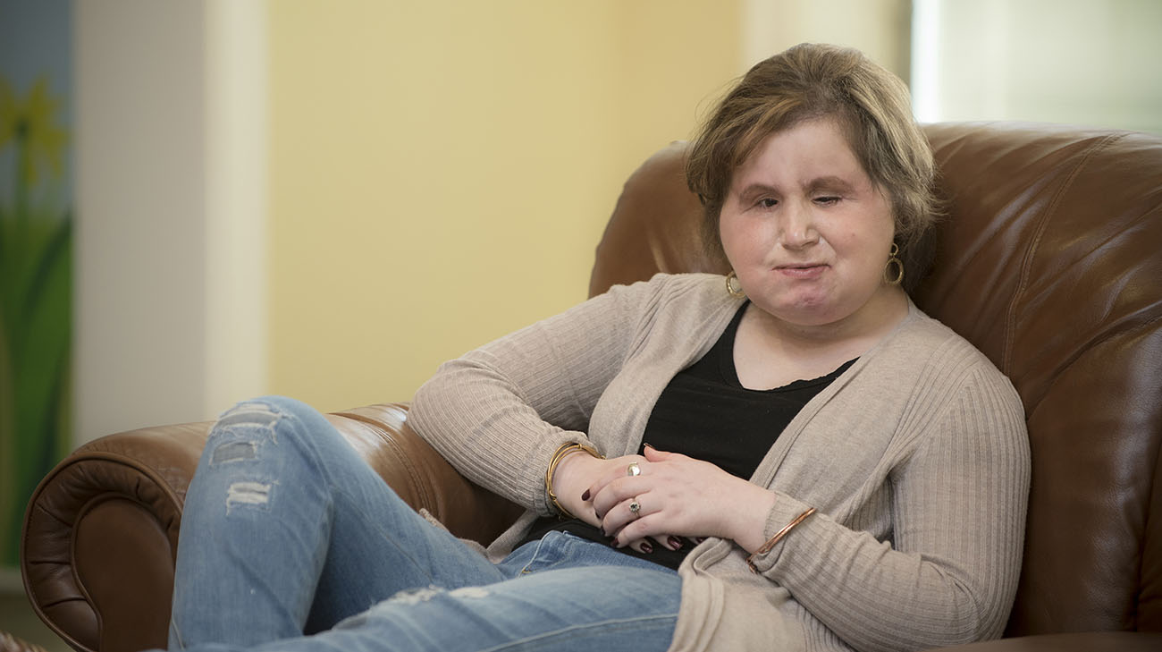 Katie Stubblefield Face Transplant Patient Story Cleveland Clinic photo