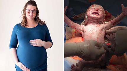 Michelle underwent a 14-hour uterus transplant that paved the way for her to give birth to baby Cole. 