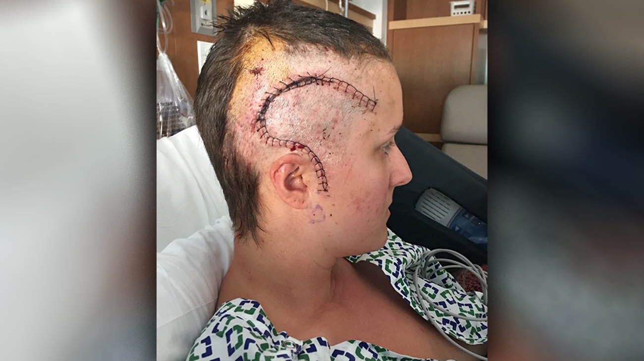 Dr. William Bingaman performed a brain surgery on Lindsey that stopped her epileptic seizures. 