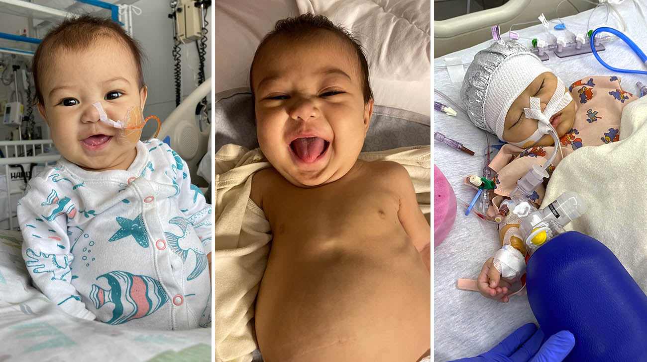 Emma developed biliary atresia and needed a liver transplant.