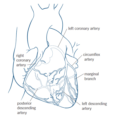 Coronary Artery Disease Overview