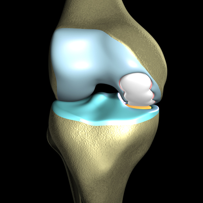 Knee Pain Treatment Guide | Cleveland Clinic