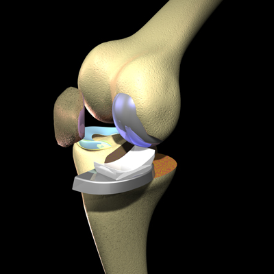 Knee Pain Treatment Guide | Cleveland Clinic