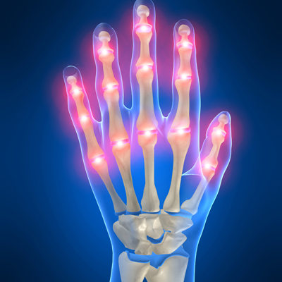 Types of Hand and Wrist Pain