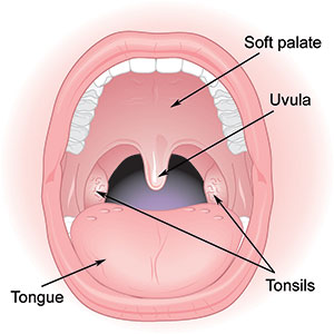 Snurken: diagram van de mond |  Cleveland kliniek