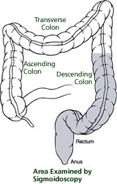 Familial Adenomatous Polyposis | Cleveland Clinic