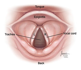 Vocal Cord Nodules, Polyps & Cysts: Treatment & Prevention