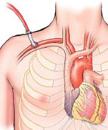 Aksillær arterie