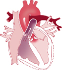 ventrikulärer Kontraktionsblutfluss