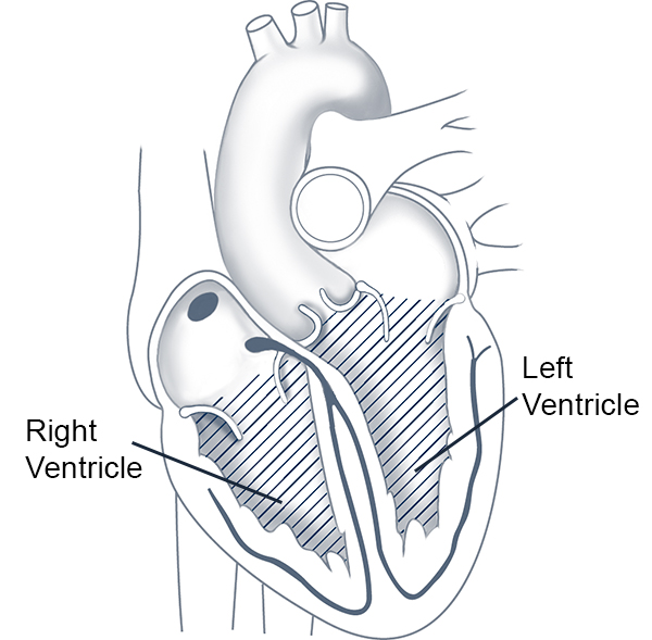 Heart Ventricles
