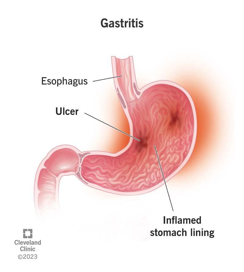 inside the stomach