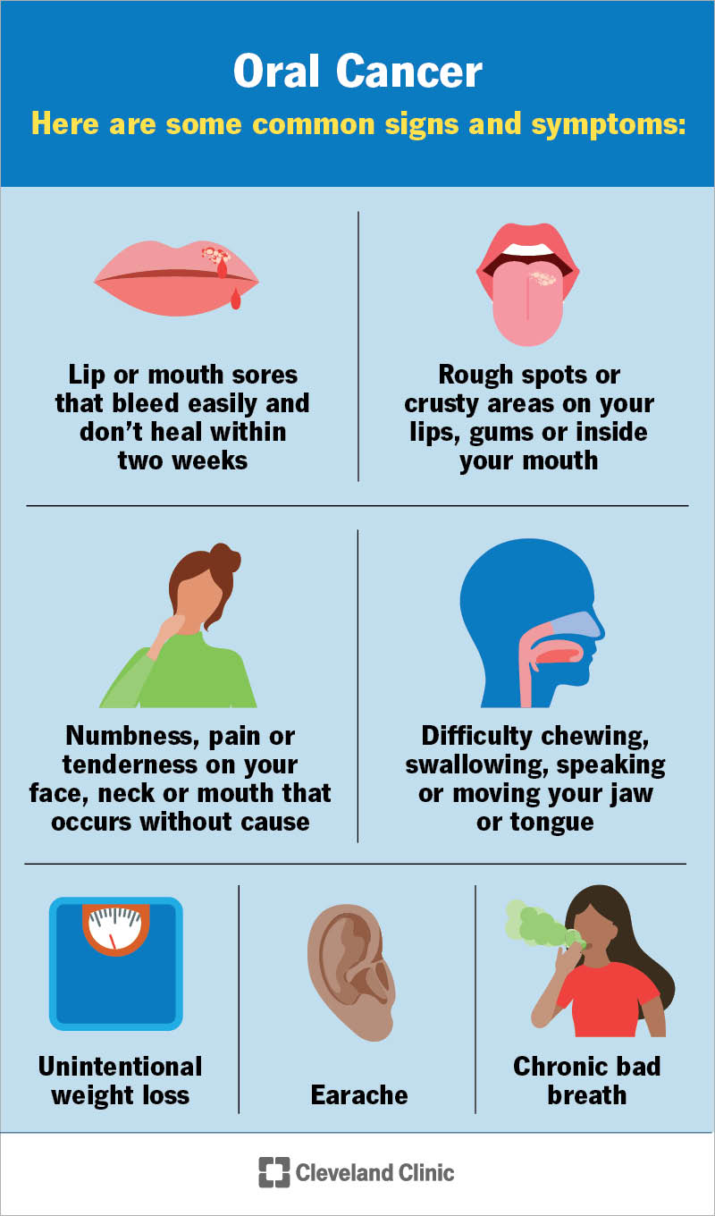Oral cancer symptoms clockwise from top left mouth sores rough spots pain difficulty chewing weight loss earache bad breath.