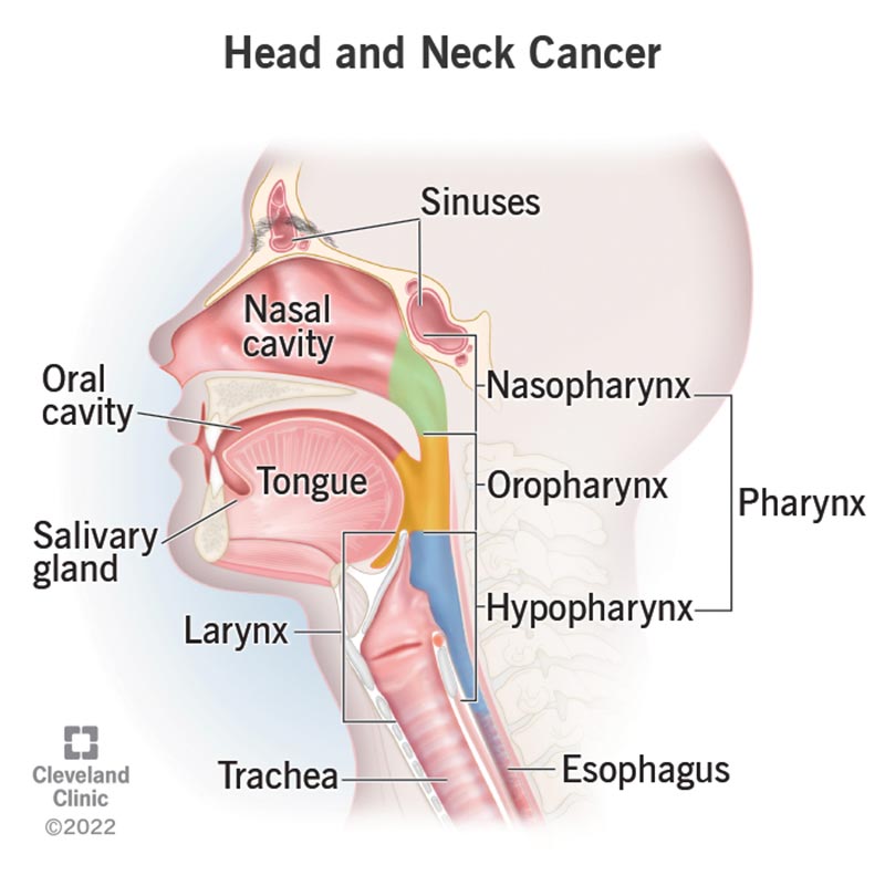 The parts of the head and neck where cancer most commonly forms.