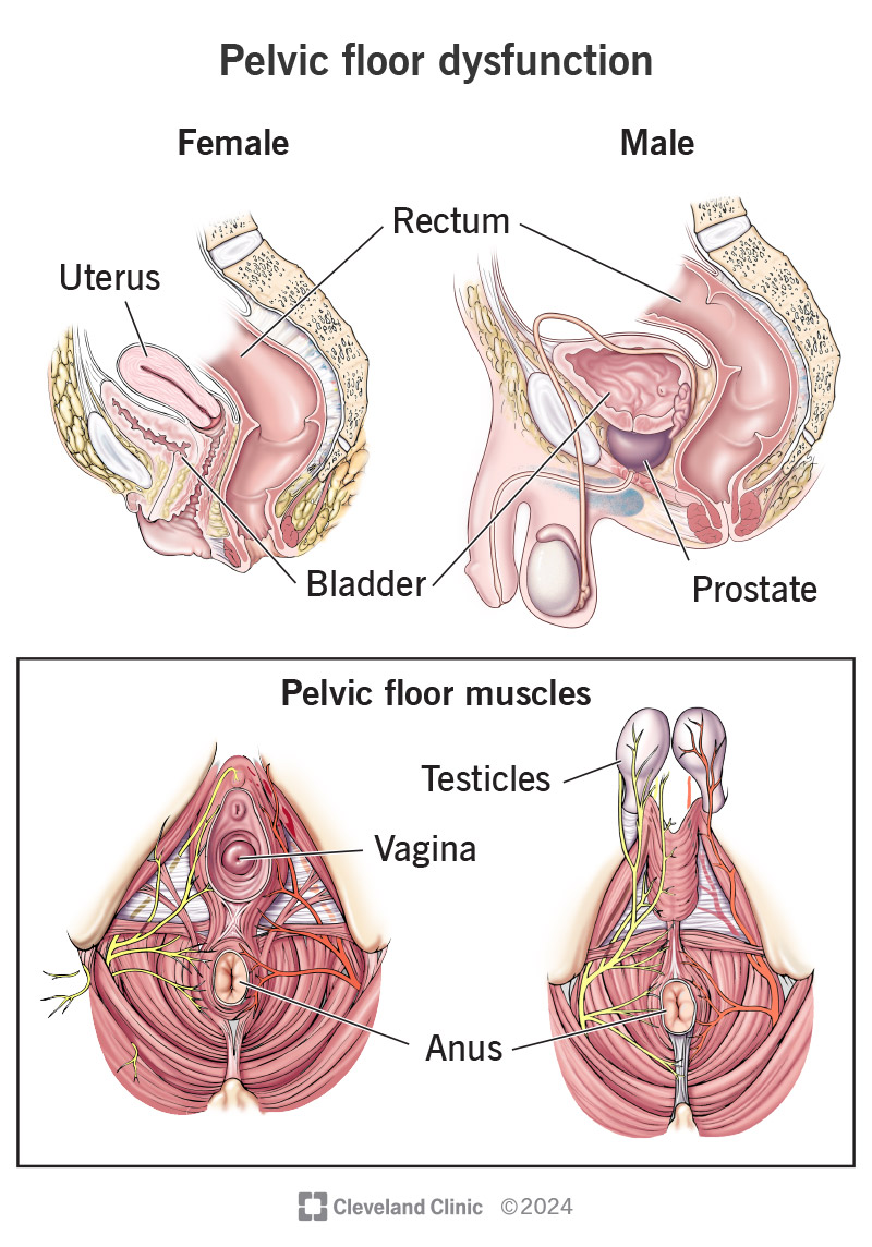 The pelvic floor muscles involved in pelvic floor dysfunction based on sex assigned at birth.