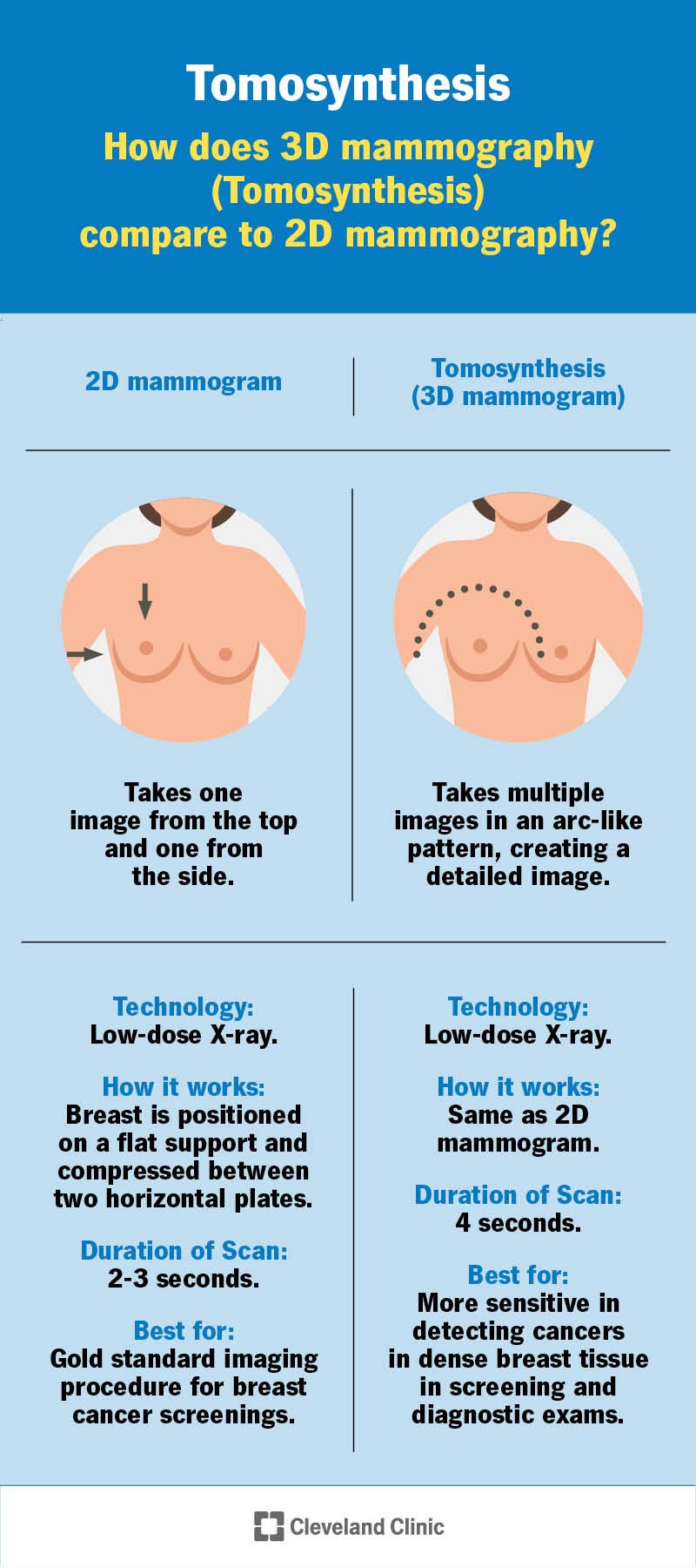 Comparison of 2D mammography and tomosynthesis