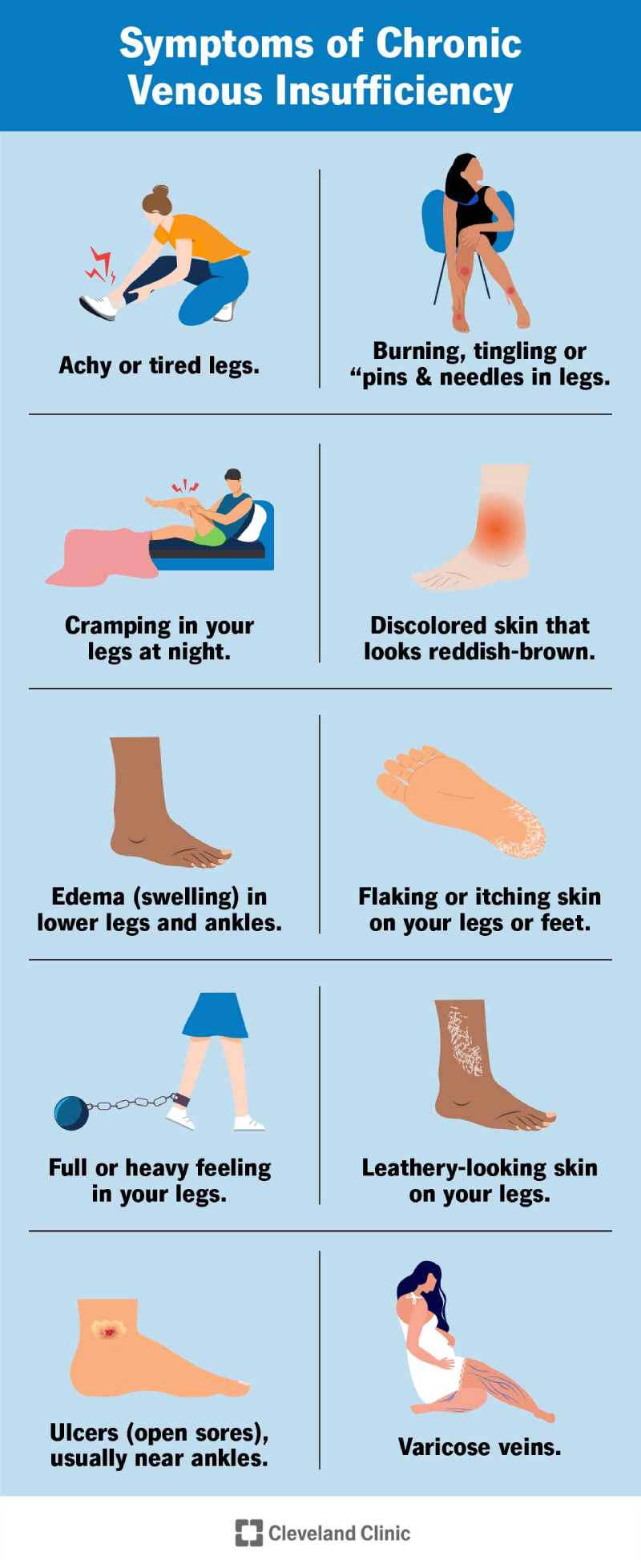 Infographic showing symptoms of chronic venous insufficiency. These include skin changes, pain and swelling in your legs and feet.