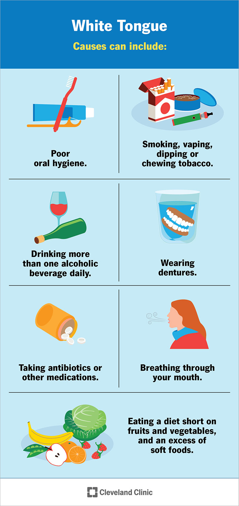 Common causes of white tongue.