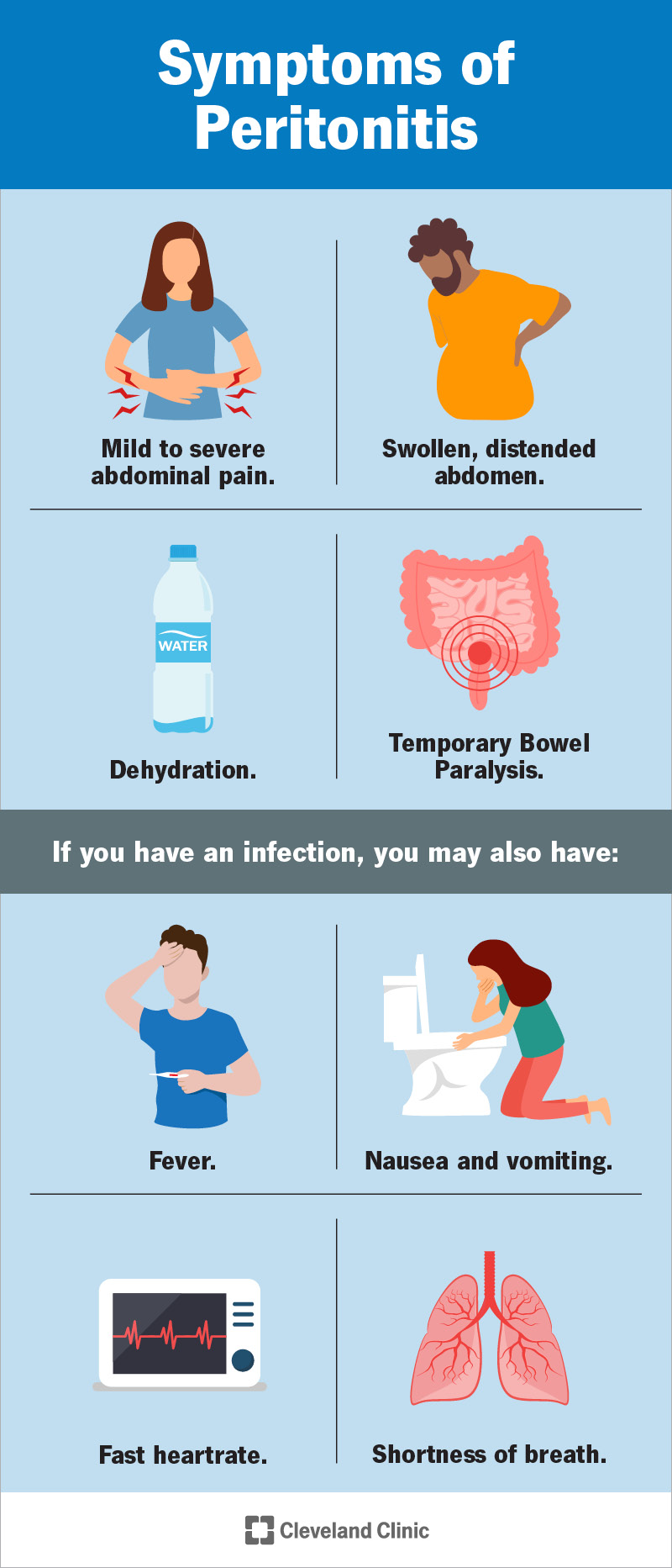 Symptoms of peritonitis include stomach pain and swelling.