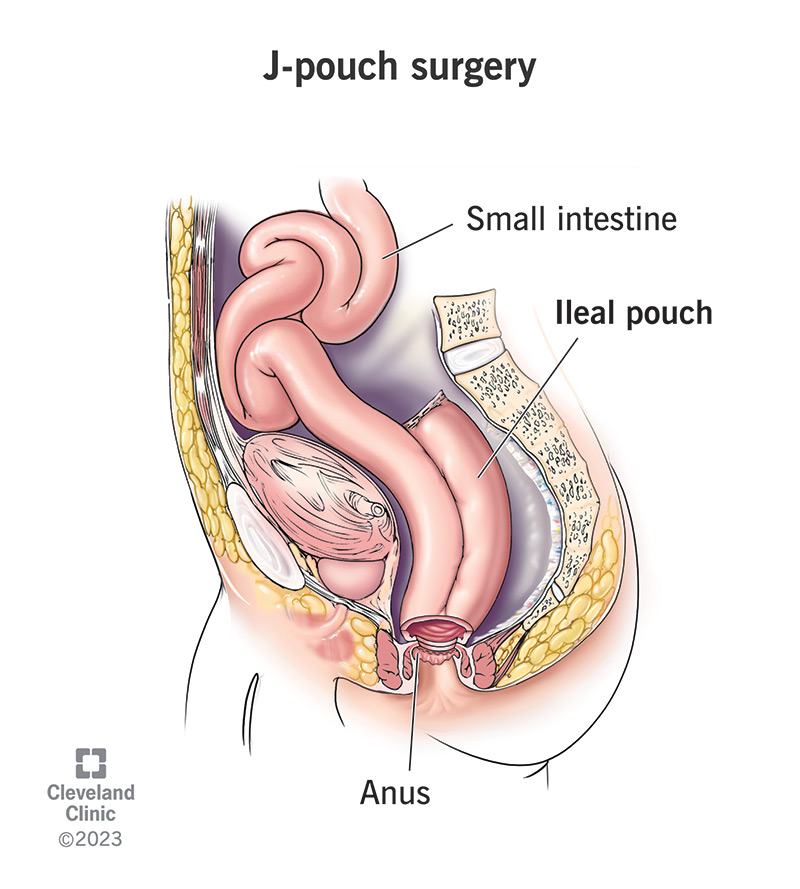The small intestine is formed into a J-shaped pouch.
