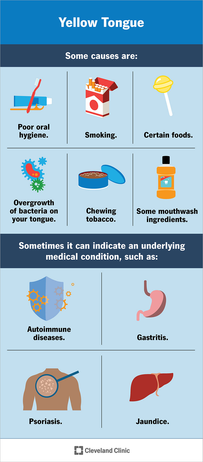 White Tongue: Causes, Treatments & Prevention