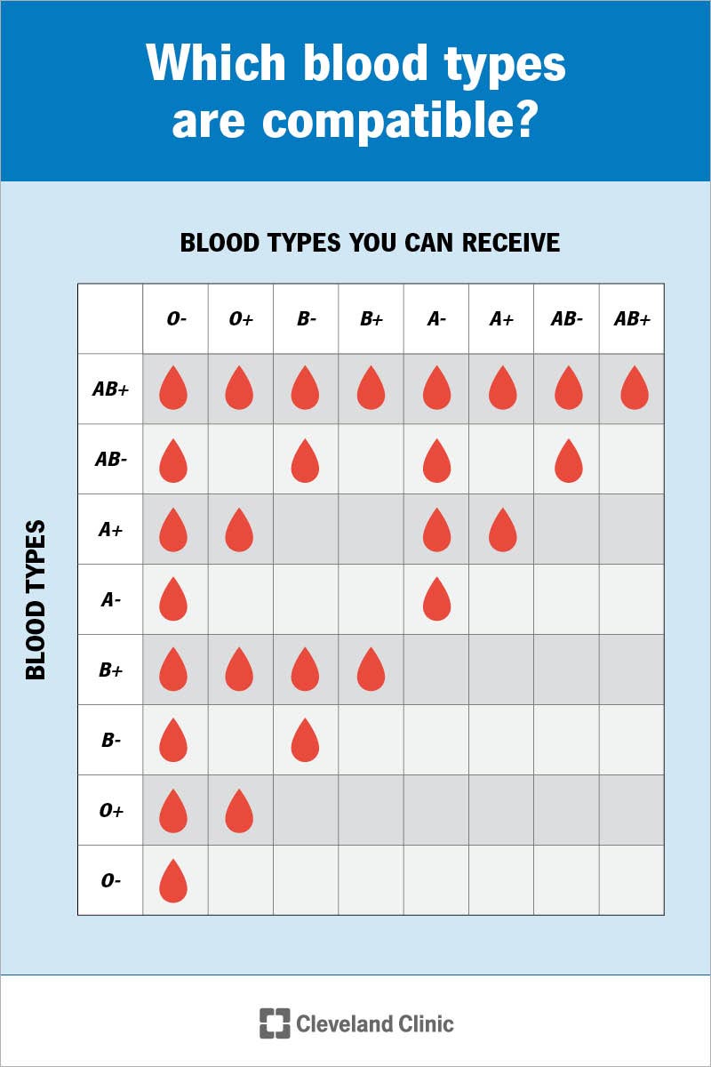 A chart showing which blood types are safe for each blood type to receive