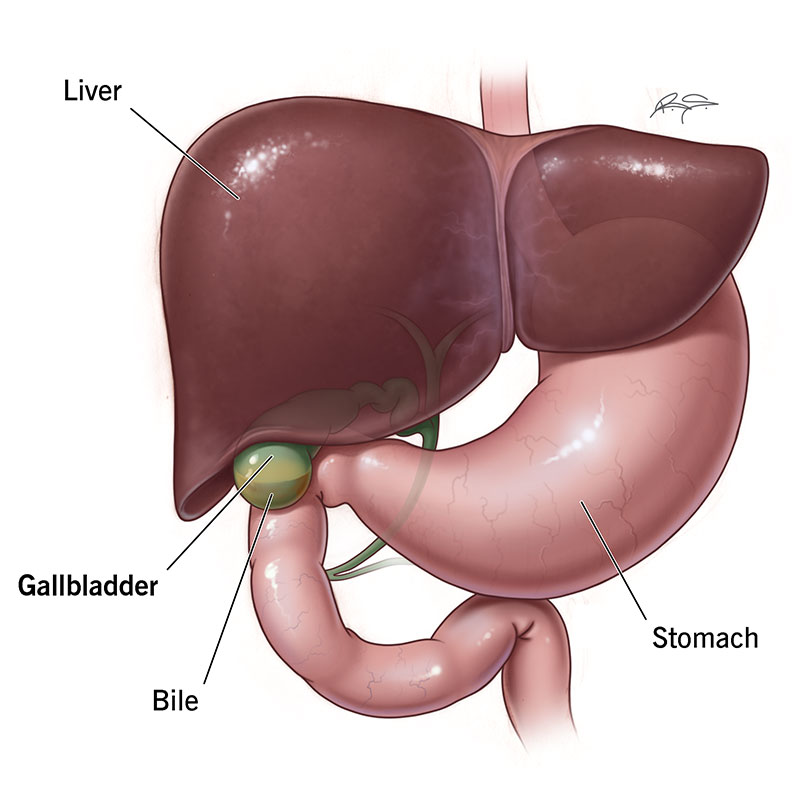 Pain in right side 2025 after eating no gallbladder