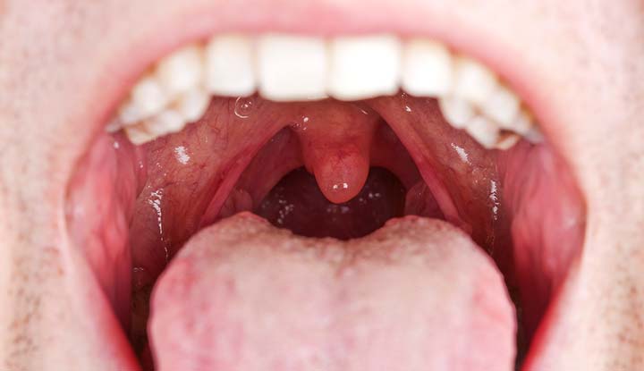 inside of the mouth