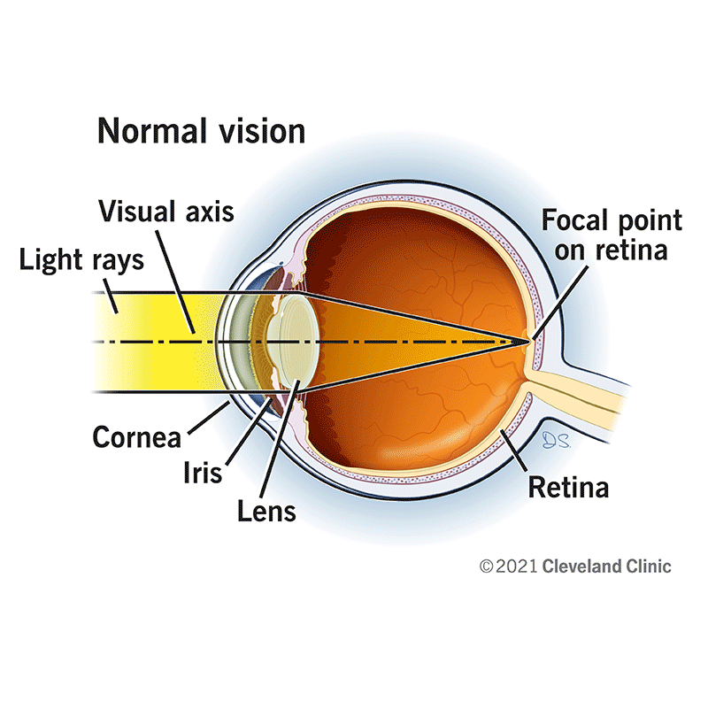 Your eye’s cornea, iris, and lens work together to bend light rays along a visual axis to the correct focal point on the retina when you have normal vision.