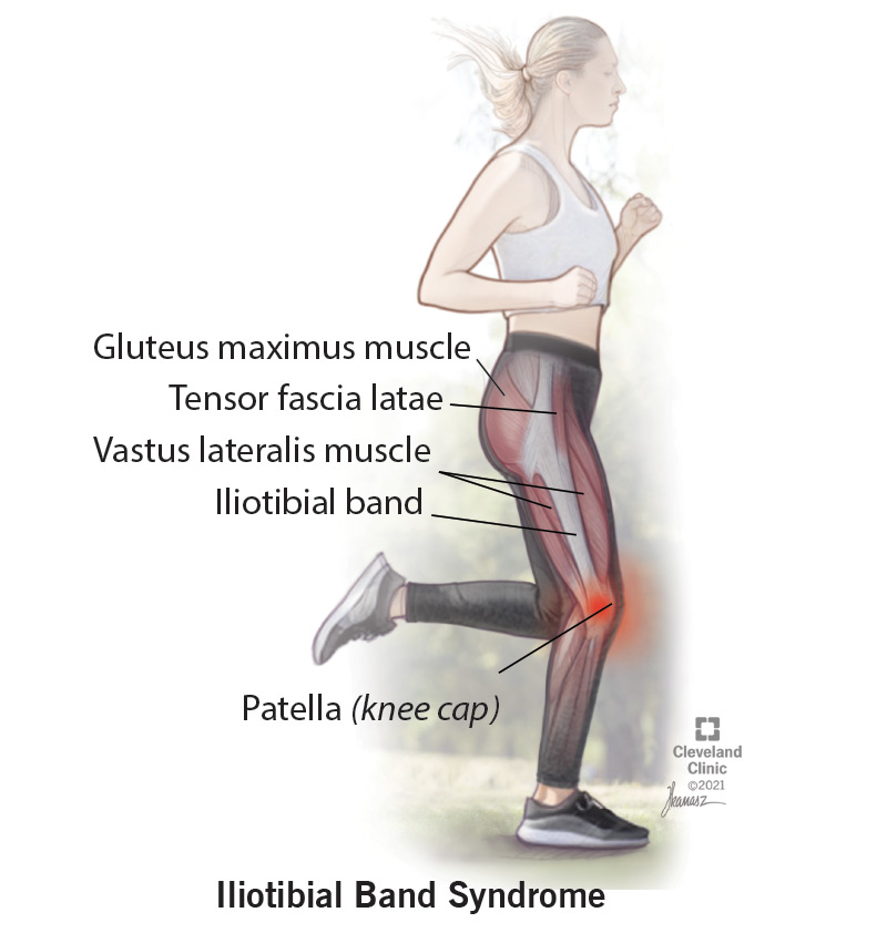 Iliotibial band is a tendon that can rub against your hip or knee bones.
