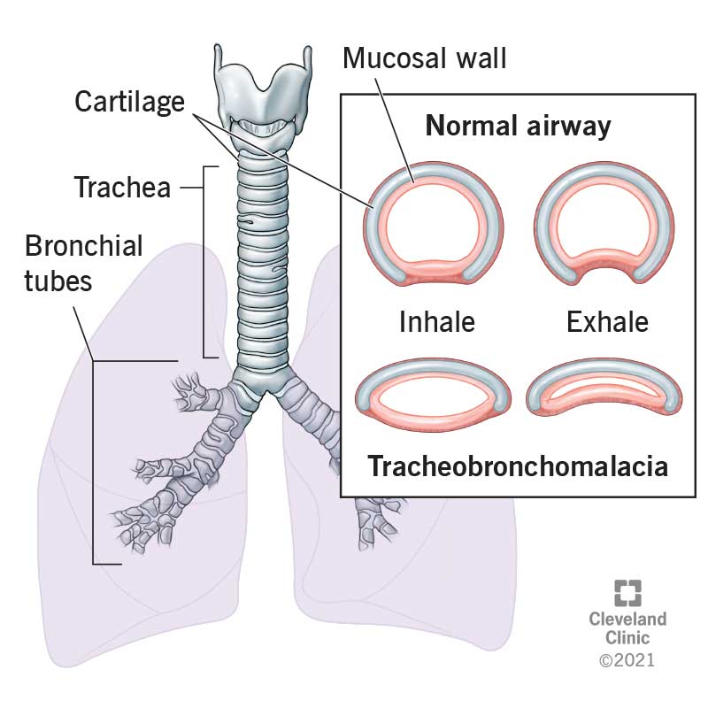 trachea and bronchi diagram