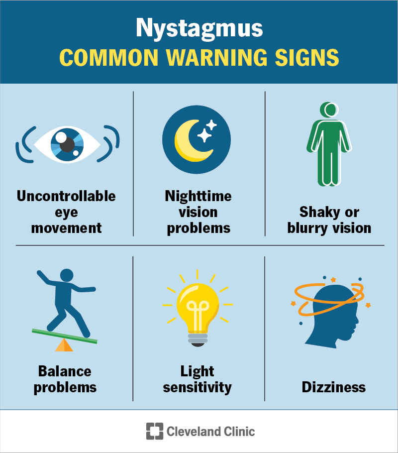 Nystagmus Definition, Causes, Testing & Treatment