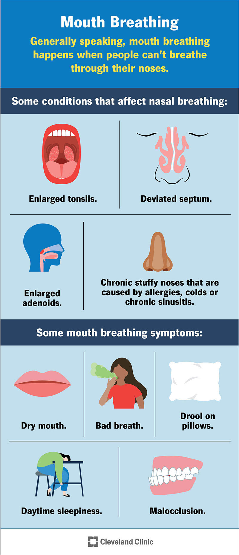 Mouth breathing causes top row left hand side: Enlarged tonsils and deviated septum. Second row left hand side: Enlarged adenoids and chronic stuffy nose from allergies, colds or chronic sinusitis. Mouth breathing symptoms top row left hand side: Dry mouth, bad breath and drool on pillow. Second row left hand side: Daytime sleepiness and malocclusion.