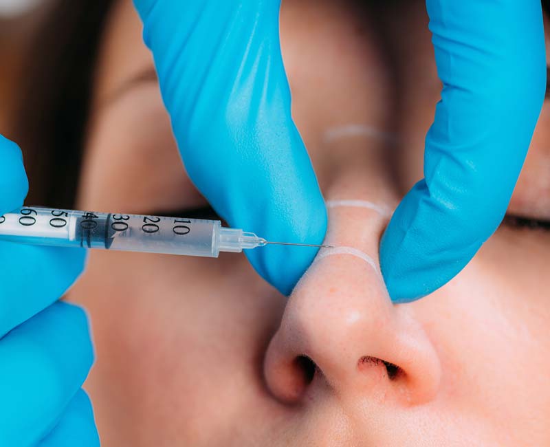Provider injecting dermal filler into a person's nose.