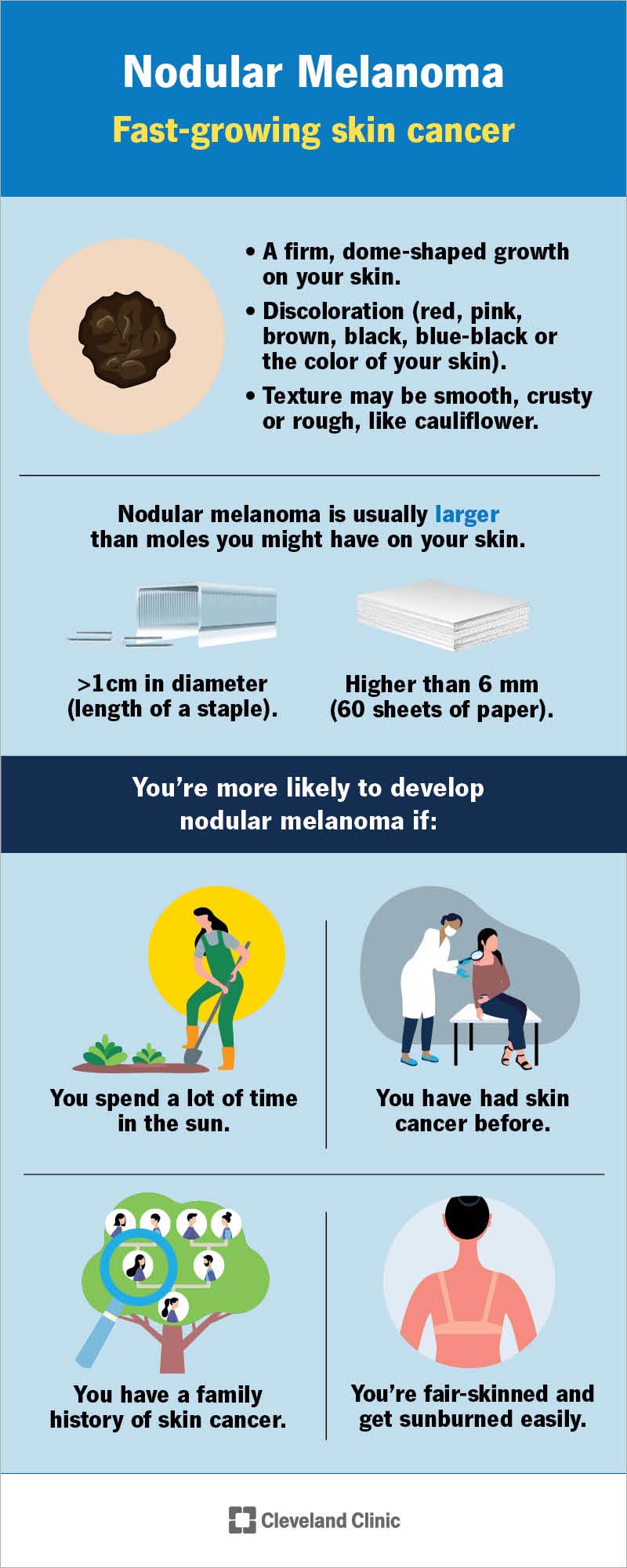 A chart describing nodular melanoma characteristics and those who are most likely to get nodular melanoma.
