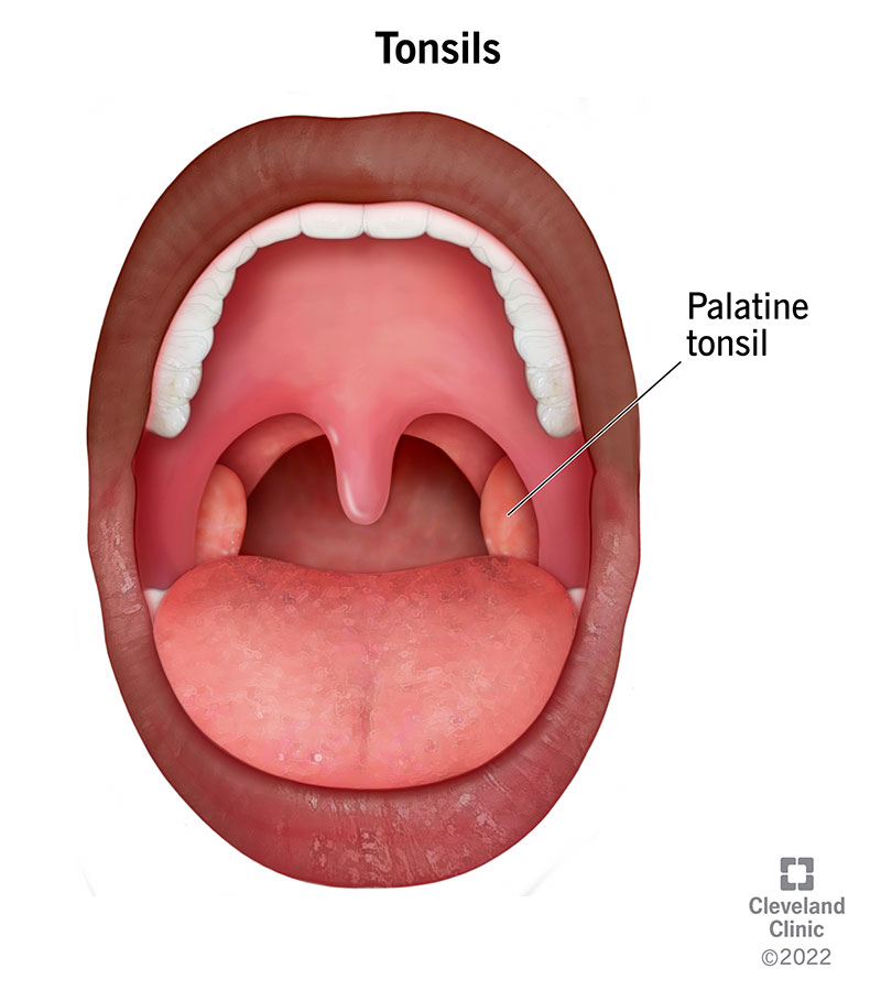 Open mouth showing back of throat and tonsils.