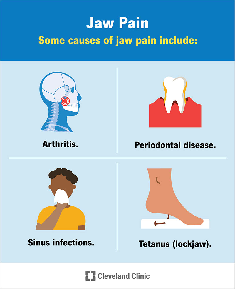 Most jaw pain is caused by temporomandibular joint disorder Other common causes include (top left) arthritis (top right) periodontal disease (bottom left and right) infections like sinusitis and lockjaw.