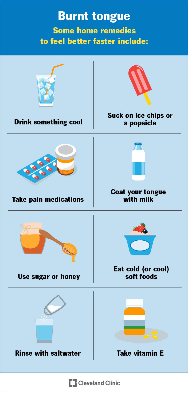 There are many ways to heal a burnt tongue