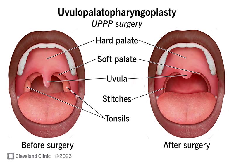 hard palate diagram