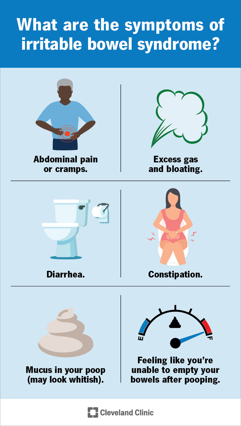 Irritable Bowel Syndrome (IBS): Symptoms, Causes & Treatment