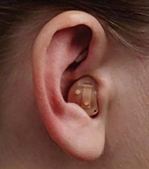 In-the-canal (ITC) hearing aid.