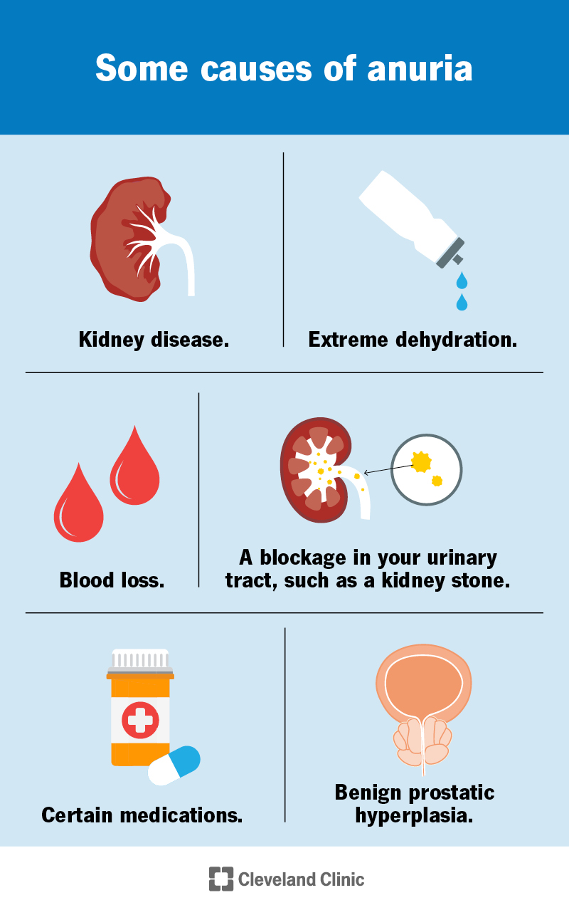 Anuria: Causes, Symptoms, Diagnosis & Treatment