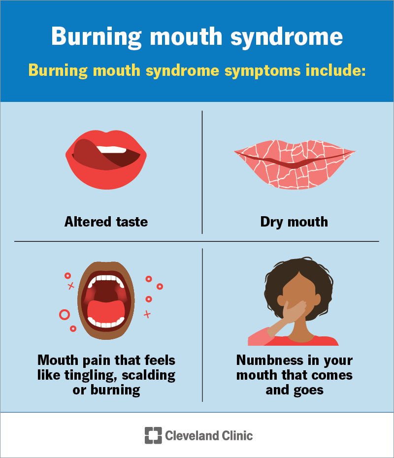 Possible burning mouth syndrome symptoms are altered taste, dry mouth, mouth pain (tingling, scalding, burning) or numbness.