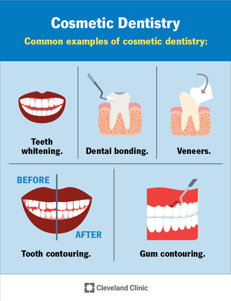 Common examples of cosmetic dentistry include teeth whitening, dental bonding, veneers, and tooth and gum contouring.