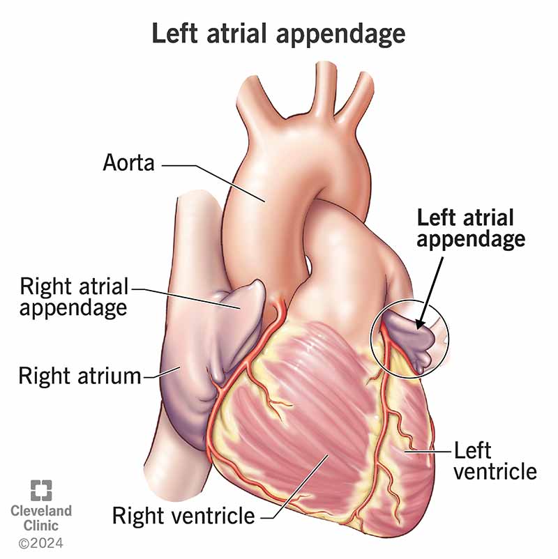 Your left atrial appendage is muscular tissue that comes out of your upper left heart chamber