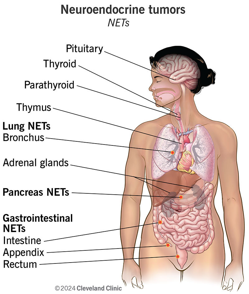 The organs and glands where neuroendocrine tumors are most likely to form