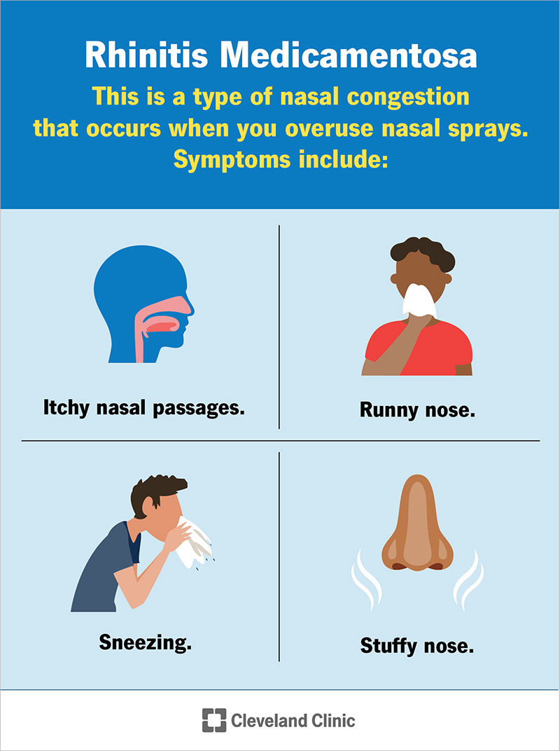 Rhinitis medicamentosa (rebound congestion) symptoms.