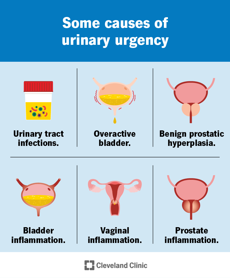 Common causes of urinary urgency include UTIs, overactive bladder, BPH and urinary tract inflammation