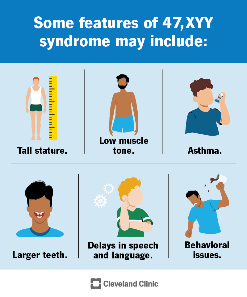 Some features of 47,XYY syndrome may include tall stature, low muscle tone, asthma, larger teeth, behavioral issues and more