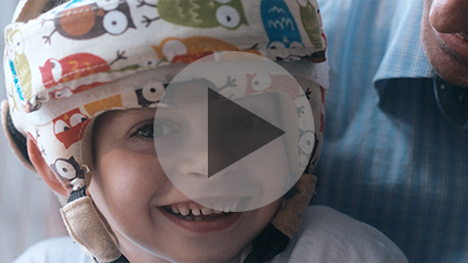 Pediatric patient with medical helmet on